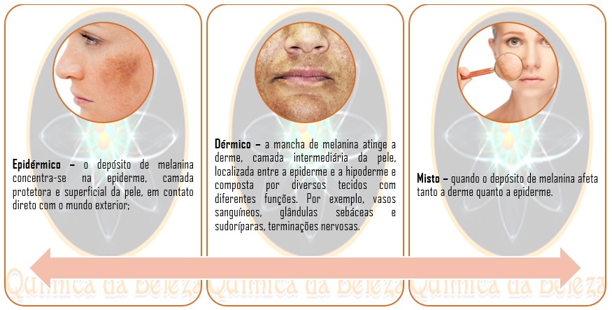 melanina tratamento valor