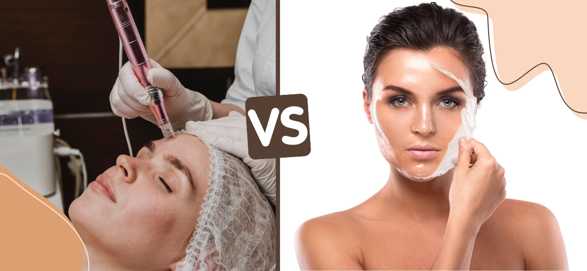 melhores resultados microagulhamento laser combinados