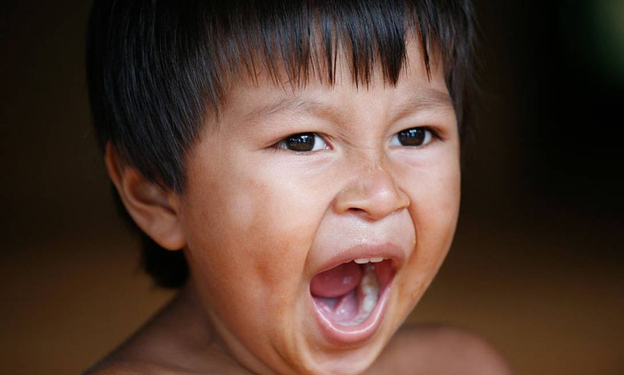 bocejo contagioso vs bocejo normal