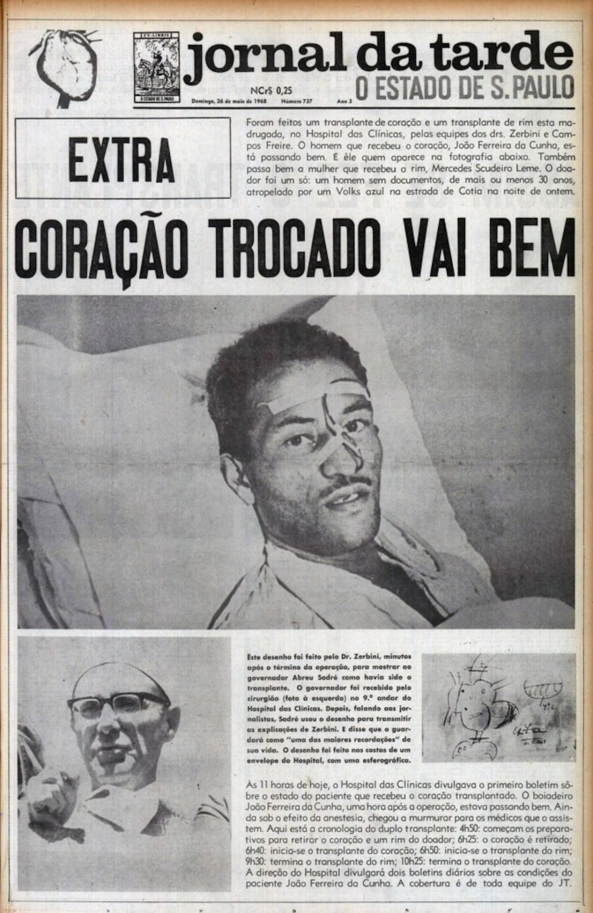 erros no primeiro transplante de coração