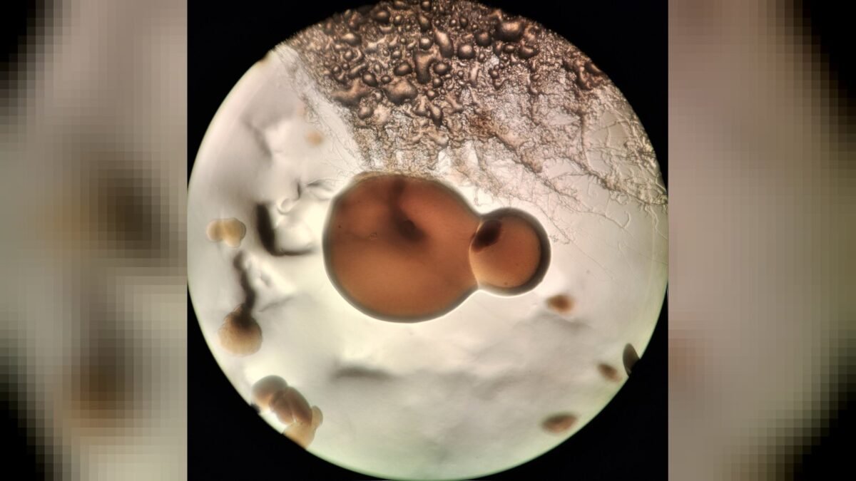 Doenças Bacterianas: O Que Seu Corpo Sente Antes de Mostrar Sinais Bacteria growth under the microscope
