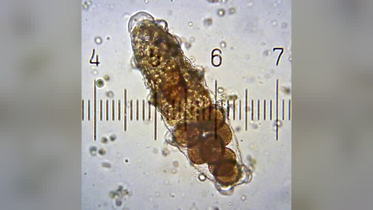 The shed cuticle of a female Tardigrade or “water bear” containing eggs. This was taken using the 10× objective and 15× eyepiece on my microscope. The